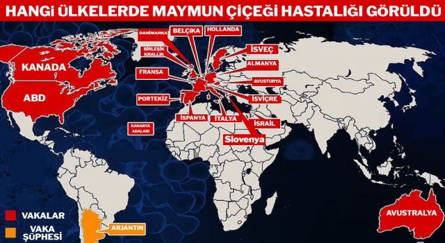 DSÖ’den Maymun Çiçeği Hastalığı Açıklaması: Nasıl Bulaştığını Duyurdular