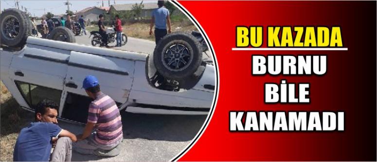 Bu Kazada Burnu Bile Kanamadı