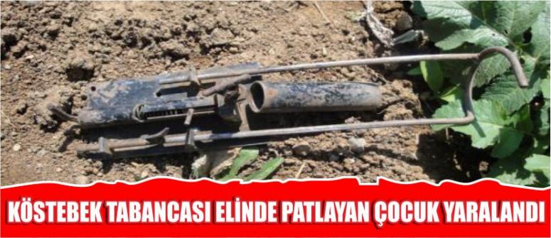 Köstebek Tabancası Elinde Patlayan Çocuk Yaralandı