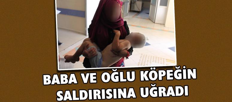 Baba Ve Oğlu Köpeğin Saldırısına Uğradı