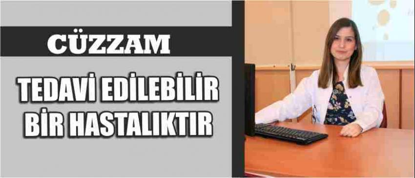Cüzzam Tedavi Edilebilir Bir Hastalıktır