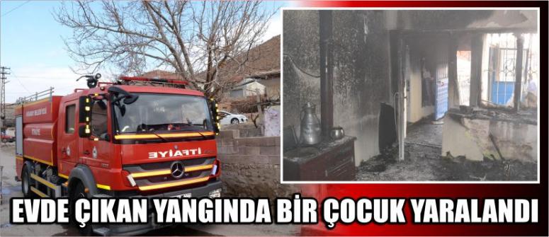 Evde Çıkan Yangında Bir Çocuk Yaralandı