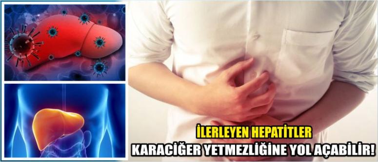 İlerleyen Hepatitler Karaciğer Yetmezliğine Yol Açabilir!
