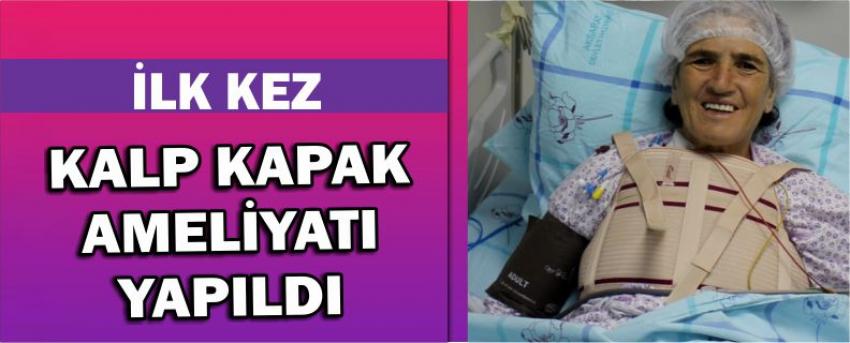 İlk Kez Kalp Kapak Ameliyatı Yapıldı