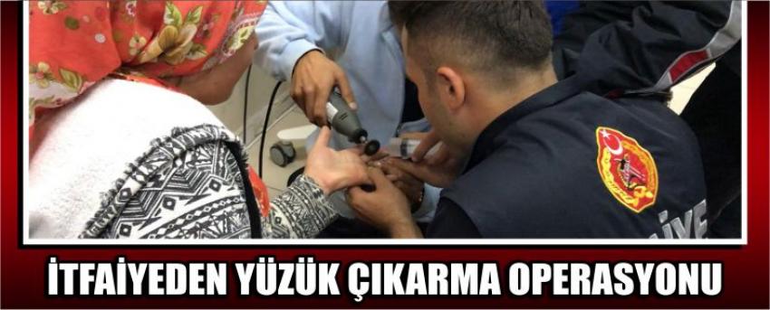 İtfaiyeden Yüzük Çıkarma Operasyonu