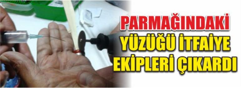 Parmağındaki Yüzüğü İtfaiye Ekipleri Çıkardı 