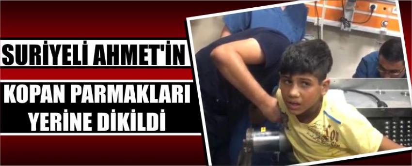 Suriyeli Ahmet'in Kopan Parmakları Yerine Dikildi