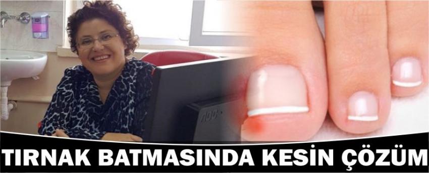Tırnak Batmasında Kesin Çözüm